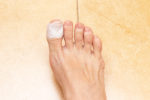 What Happens When You Lose A Toenail? – My FootDr