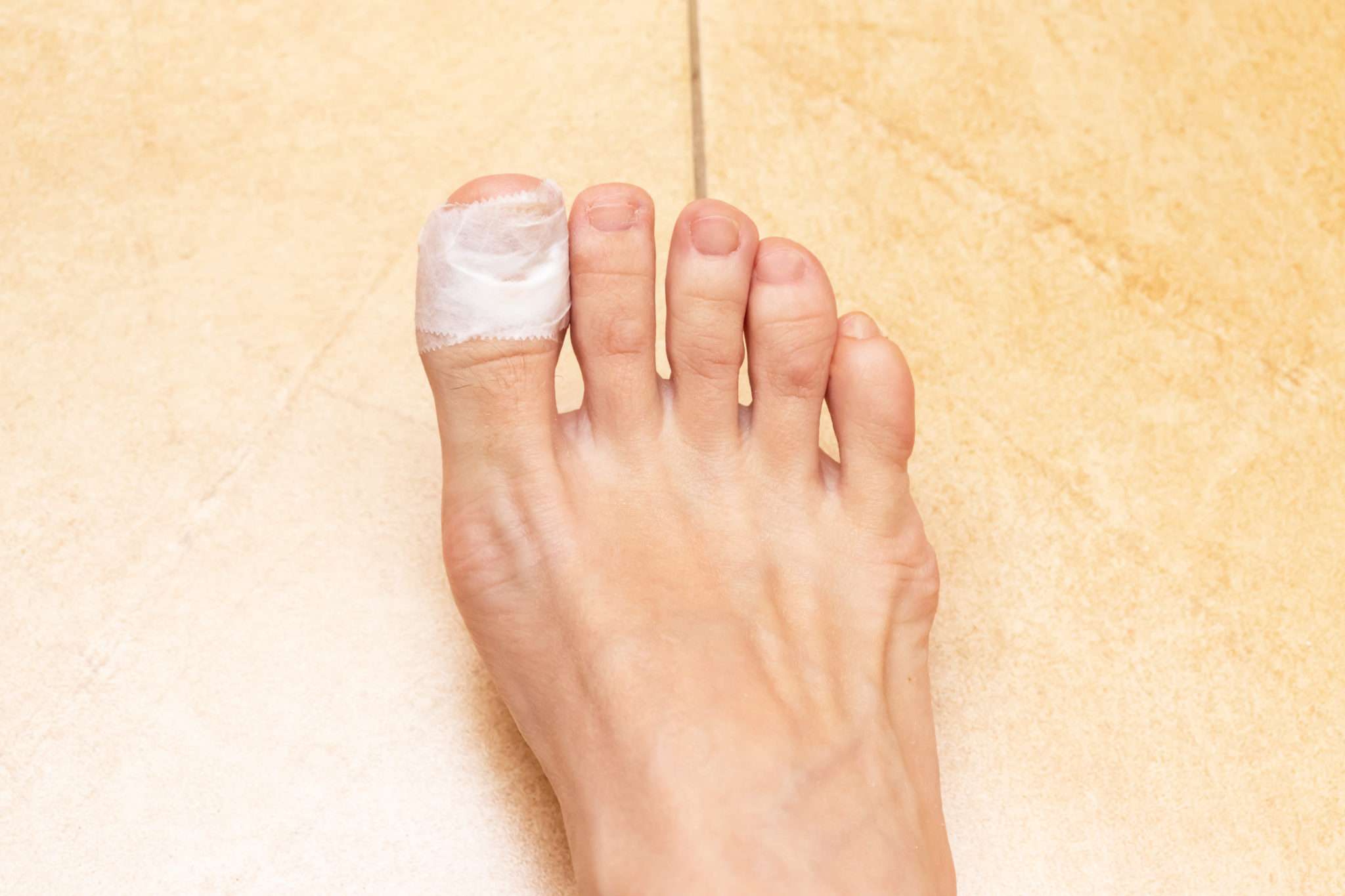 Medical Conditions Associated with Big Toe Nail Changing Color and Falling Off - wide 4