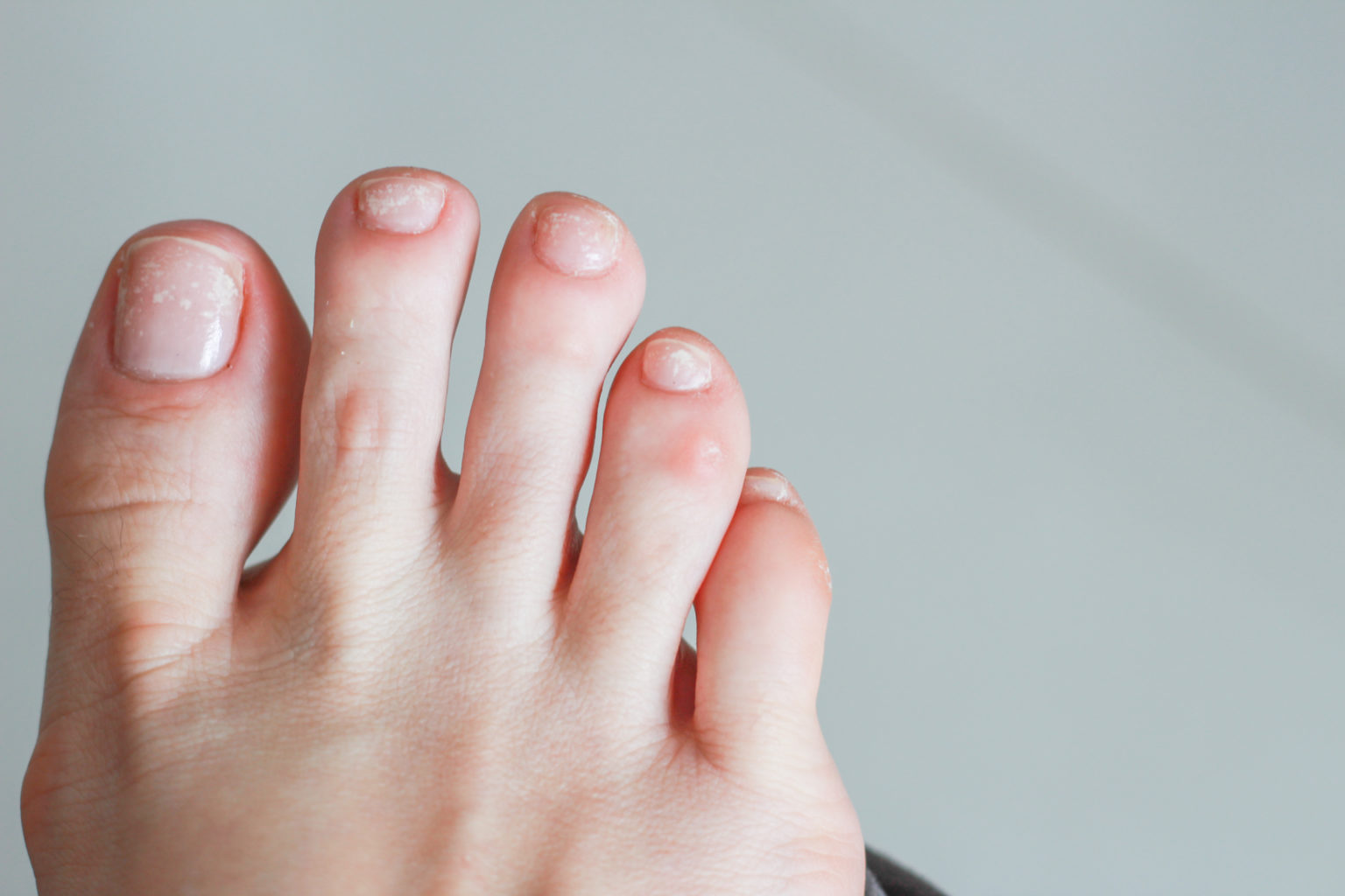 may toe nail color