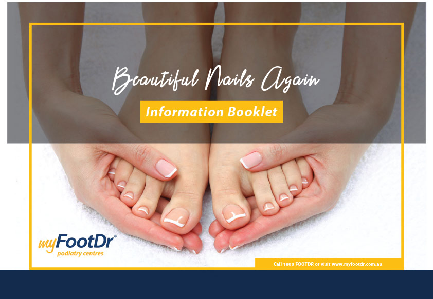 My FootDr Fungal Nail Treatment Guide