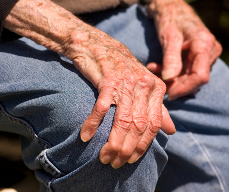 What Causes Gout In The Foot My FootDr What causes gout in the foot my footdr